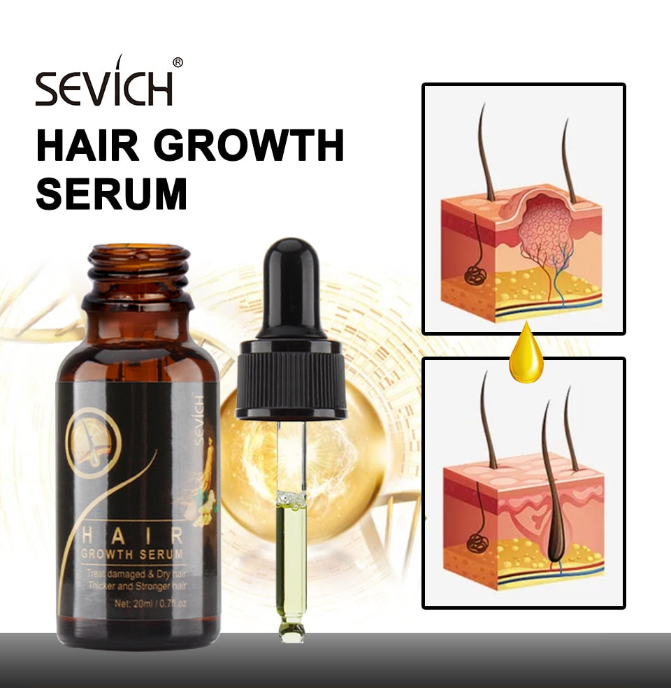 Hair Growth Products Sevich Ginger Essence Hair Growing Essential Oil Serum Hair Care Prevent Hair Loss Scalp Treatment 20ml