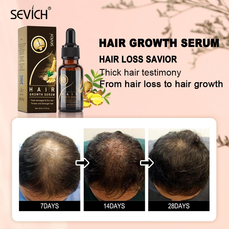 Hair Growth Products Sevich Ginger Essence Hair Growing Essential Oil Serum Hair Care Prevent Hair Loss Scalp Treatment 20ml