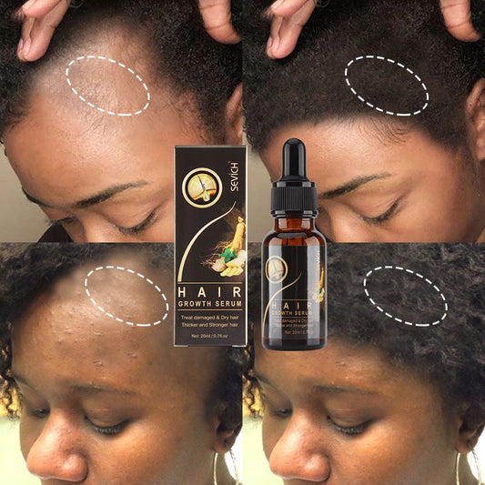 Hair Growth Products Sevich Ginger Essence Hair Growing Essential Oil Serum Hair Care Prevent Hair Loss Scalp Treatment 20ml